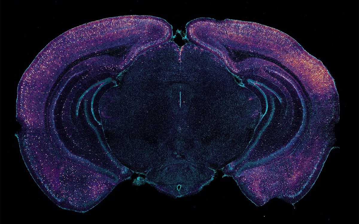 a-colored-microscope-image-of-an-animal-brain-with-many-dots-lit-within.jpg Microscope image of animal brain