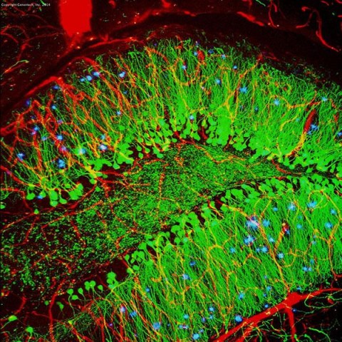 https://neuro.gatech.edu/sites/default/files/Hg_News/1-17-alz-fig-amyloid_0.jpg https://neuro.gatech.edu/sites/default/files/Hg_News/1-17-alz-fig-amyloid_0.jpg