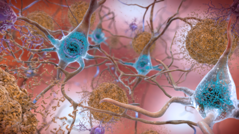 https://neuro.gatech.edu/sites/default/files/Hg_News/AmyloidB.pTau_.NIH__0.jpg https://neuro.gatech.edu/sites/default/files/Hg_News/AmyloidB.pTau_.NIH__0.jpg
